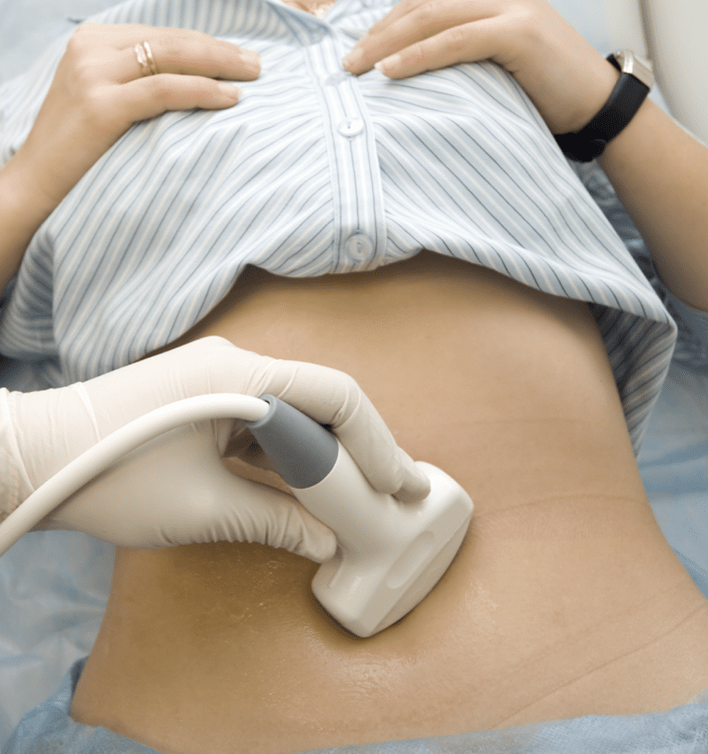 A woman receiving a free ultrasound in Branson West, Missouri